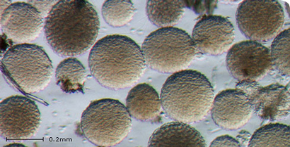 [CORDIS] Myxozoa, parassiti che preoccupano, sotto il vetrino dei ricercatori